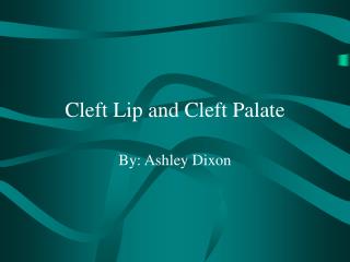 Cleft Lip and Cleft Palate