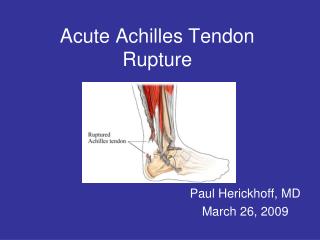 Acute Achilles Tendon Rupture
