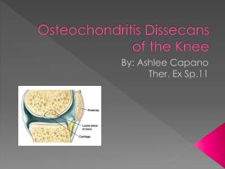 Osteochondritis Dissecans of the Knee