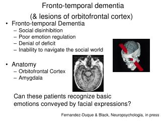 Fronto-temporal dementia (&amp; lesions of orbitofrontal cortex)