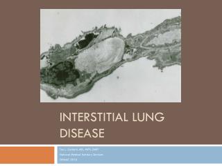 Interstitial Lung Disease