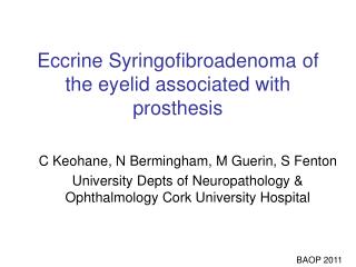 Eccrine Syringofibroadenoma of the eyelid associated with prosthesis