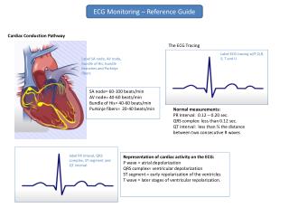 Normal measurements: PR Interval: 0.12 – 0.20 sec. QRS complex: less than 0.12 sec.