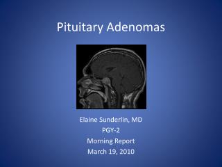 Pituitary Adenomas