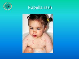 Rubella rash