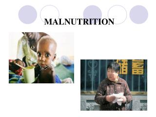 MALNUTRITION