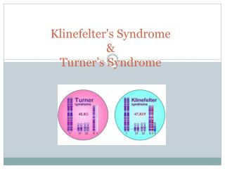 Klinefelter's S yndrome &amp; Turner’s Syndrome