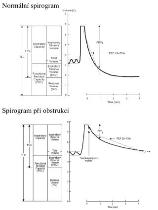 Normální spirogram