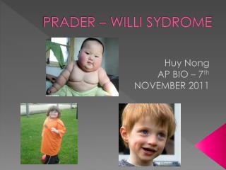 PRADER – WILLI SYDROME