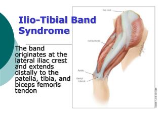 Ilio-Tibial Band Syndrome