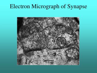 Electron Micrograph of Synapse