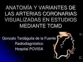 ANATOMÍA Y VARIANTES DE LAS ARTERIAS CORONARIAS VISUALIZADAS EN ESTUDIOS MEDIANTE TCMD