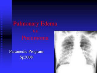 Pulmonary Edema vs Pneumonia