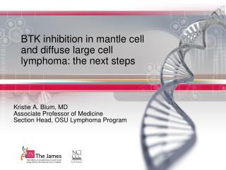 BTK inhibition in mantle cell and diffuse large cell lymphoma: the next steps