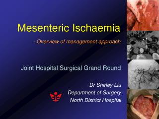Mesenteric Ischaemia - Overview of management approach