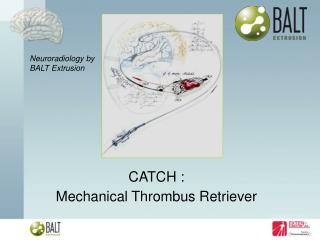 CATCH : Mechanical Thrombus Retriever