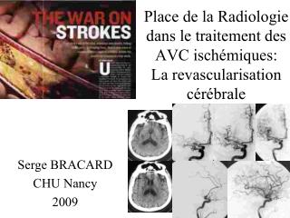 Place de la Radiologie dans le traitement des AVC ischémiques: La revascularisation cérébrale