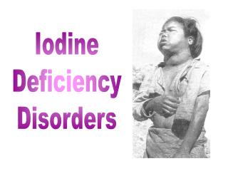 Iodine Deficiency Disorders