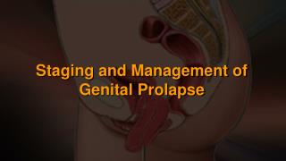 Staging and Management of Genital Prolapse