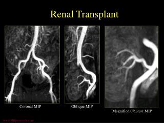 Renal Transplant