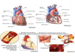 Coronary heart disease (CHD) is a narrowing of the small blood vessels that supply blood and oxygen to the heart.