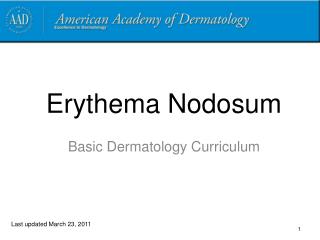 Erythema Nodosum