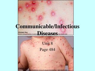 Communicable/Infectious Diseases