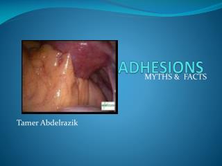 ADHESIONS