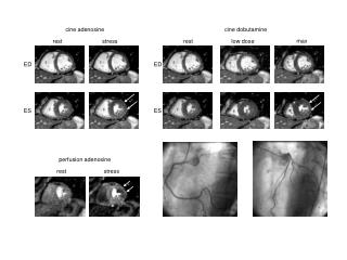 cine dobutamine