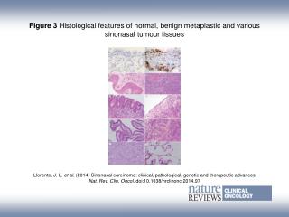 Figure 3 Histological features of normal, benign metaplastic and various sinonasal tumour tissues