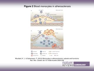 Figure 2 Blood monocytes in atherosclerosis