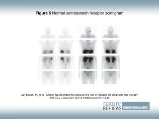 Figure 5 Normal somatostatin receptor scintigram