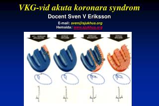 VKG-vid akuta koronara syndrom