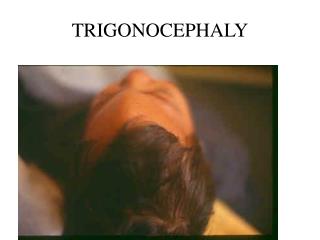 TRIGONOCEPHALY