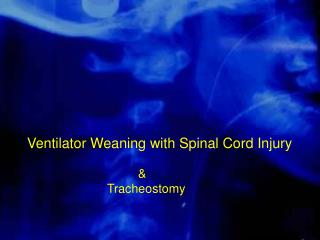 Ventilator Weaning with Spinal Cord Injury