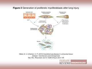 Figure 2 Generation of profibrotic myofibroblasts after lung injury