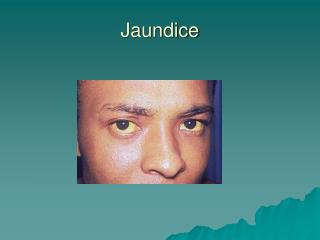 Jaundice