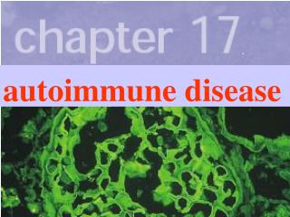 autoimmune disease