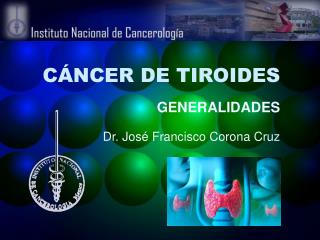 CÁNCER DE TIROIDES