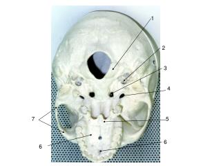 Incisive foramen