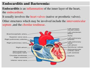 Endocarditis and Bacteremia: