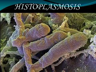 HISTOPLASMOSIS