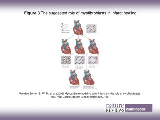 Figure 3 The suggested role of myofibroblasts in infarct healing
