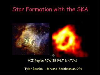 Star Formation with the SKA