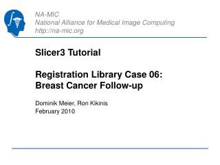 Slicer3 Tutorial Registration Library Case 06: Breast Cancer Follow-up