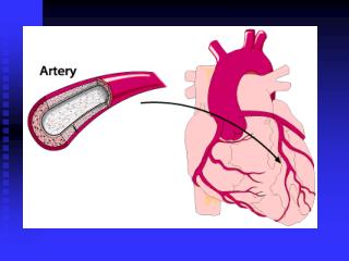 Normal heart