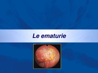 Le ematurie