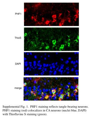 Supplemental Fig. 1. PHF1 staining reflects tangle-bearing neurons.