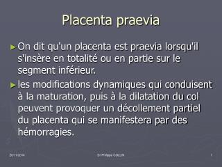 Placenta praevia