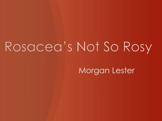 Rosacea’s Not So Rosy